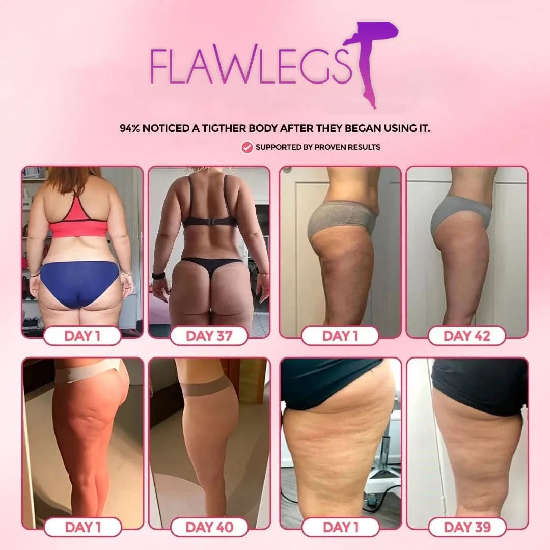 FlawLegs Anti-Cellulite real results