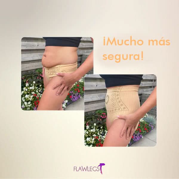 FlawSlim™ - Slimming shapewear | BUY 1, GET 3 + SPECIAL GIFT